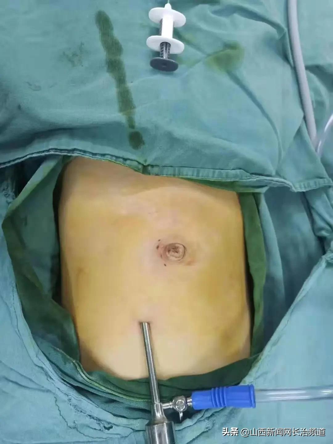 什么樣的疤痕不能當(dāng)兵？深入了解征兵體檢中的疤痕要求，征兵體檢中的疤痕要求，哪些疤痕影響入伍資格？