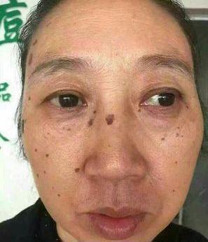 去老年斑的簡(jiǎn)單方法，重拾肌膚光彩的秘訣，去老年斑秘籍，重拾肌膚光彩的簡(jiǎn)易方法