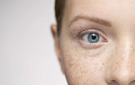 如何判斷臉上是什么斑——圖片輔助解析，臉上斑點(diǎn)的判斷與識別，圖片輔助解析指南