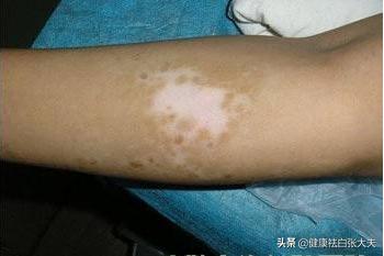 維生素C的益處，健康生活的秘密武器，維生素C的奧秘，健康生活的秘密武器