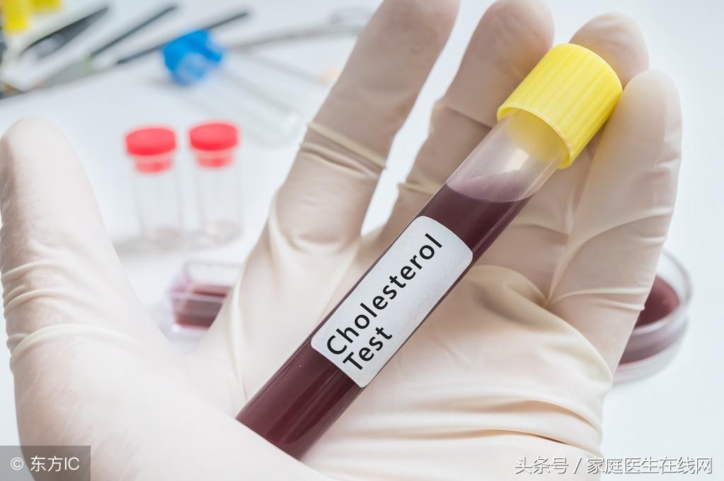 糖尿病的成因，深度解析其背后的原因，深度解析糖尿病成因，揭示背后原因真相