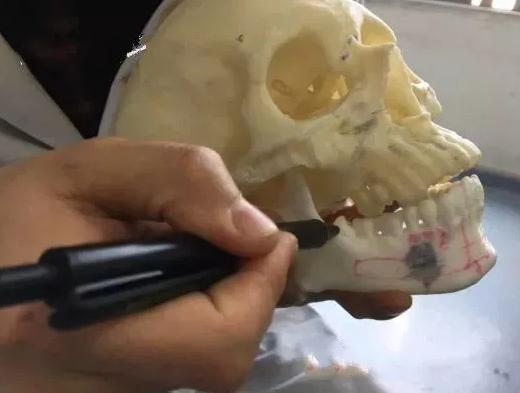 智齒的形態(tài)與圖片解析，了解牙齒生長的最后階段，智齒形態(tài)與圖片解析，探究牙齒生長最后階段的全貌