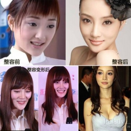 哪些女明星整容？深度解析背后的故事，深度解析女明星整容背后的故事