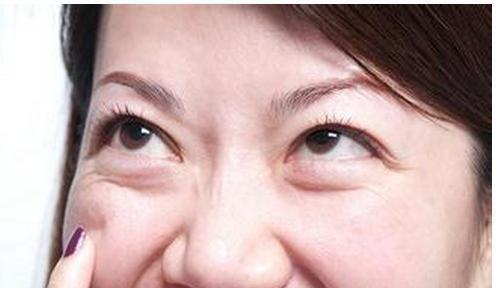 如何消除眼袋，方法與技巧詳解，消除眼袋的有效方法與技巧全解析