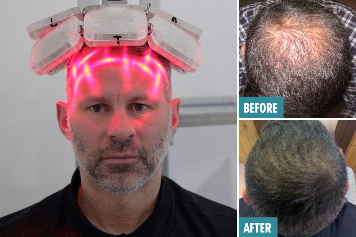 激光手術費用詳解，多少錢一次？，激光手術費用全面解析，手術費用究竟是多少？